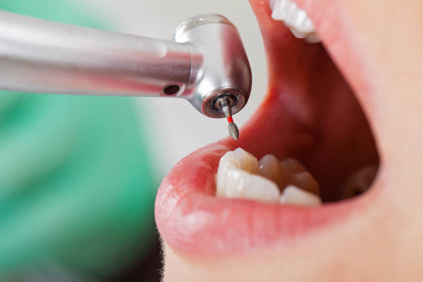 Best Urgent Tooth Repair  in Los Banos, CA